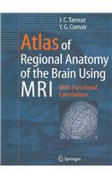 Atlas of Regional Anatomy of the Brain Using MRI