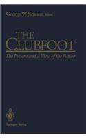 Clubfoot