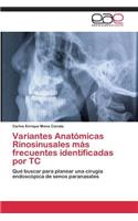 Variantes Anatómicas Rinosinusales más frecuentes identificadas por TC