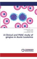 A Clinical and Fnac Study of Gingiva in Acute Leukemia