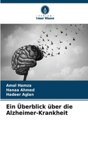 Überblick über die Alzheimer-Krankheit