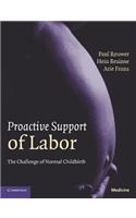 Proactive Support of Labor
