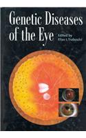 Genetic Diseases of the Eye (Oxford Monographs on Medical Genetics)