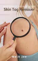 Skin Tag Remover: Natural Remedies for Removing Skin Tag Safely