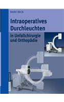 Intraoperatives Durchleuchten in Unfallchirurgie und Orthopädie
