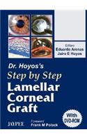 Dr Hoyos’s Step by Step Lamellar Corneal Graft (with DVD-ROM)