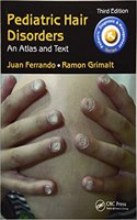 Pediatric Hair Disorders