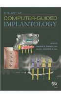 Art of Computer-Guided Implantology
