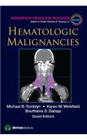 Hematologic Malignancies