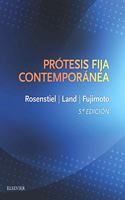 Protesis fija contemporanea (5a ed.)
