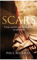 Scars