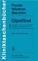 Gipsfibel
