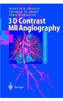 3D Contrast Mr Angiography