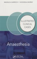 Anaesthesia