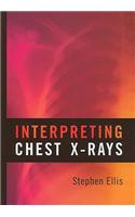 Interpreting Chest X-Rays