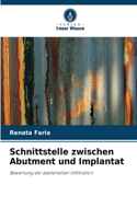 Schnittstelle zwischen Abutment und Implantat