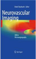 Neurovascular Imaging