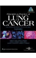 Principles and Practice of Lung Cancer