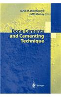 Bone Cements and Cementing Technique