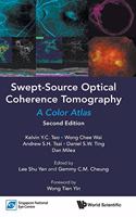 Swept-Source Optical Coherence Tomography