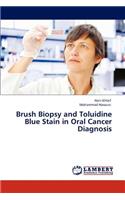 Brush Biopsy and Toluidine Blue Stain in Oral Cancer Diagnosis