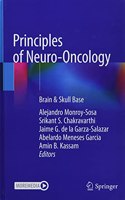 Principles of Neuro-Oncology