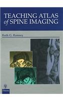 Teaching Atlas of Spine Imaging