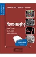 Neuroimaging