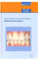 Indirect Restorations