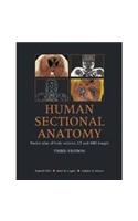 Human Sectional Anatomy Atlas of Body Sections, CT and MRI Images