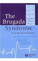 The Brugada Syndrome