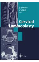 Cervical Laminoplasty