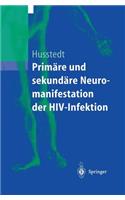 Primäre Und Sekundäre Neuromanifestationen Der Hiv-Infektion