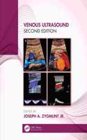 Venous Ultrasound