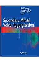 Secondary Mitral Valve Regurgitation