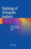 Radiology of Orthopedic Implants