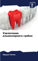 Увеличение альвеолярного гребня
