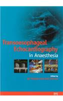 Transoesophageal Echocardiography in Anaesthesia