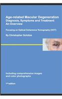 Age-related Macular Degeneration, Diagnosis, Symptoms and Treatment, An Overview