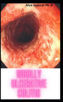 Wholly Ulcerative Colitis