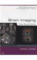 Brain Imaging: Case Review Series