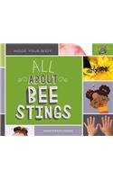 All about Bee Stings