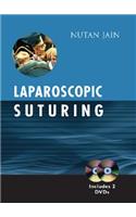 Laparoscopic Suturing