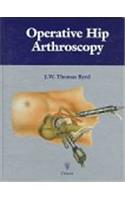 Operative Hip Arthroscopy