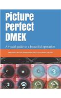 Picture Perfect Dmek
