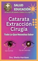 Cirugía De Extracción De Cataratas: Todo Lo Que Necesitas Saber: Cirugía De Extracción De Cataratas: Preparación, Contribución Personal, Procedimiento, Tratamiento y Curación