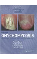 Onychomycosis