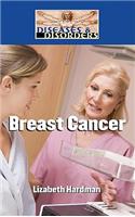 Breast Cancer