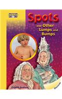 Spots and Other Lumps and Bumps: (High-Fliers)