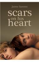 Scars on His Heart